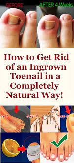 Pin On Stay Naturally Healthy