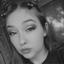 After just 5 days of cleaning, antibiotics, and bandage changes, check out  the amazing progress of Kalista's embedded collar wound! It's unbelievable  how fast it is healing and how much better it