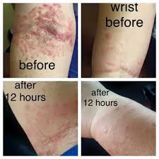 Monat Before And After 101 Uses Rejuveniqe Oil Non Toxic Hair Care Hair Extensions Nope Monat Liquid Gold Monat Before And After Monat Monat Hair