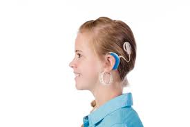 Image result for Cochlear Implant