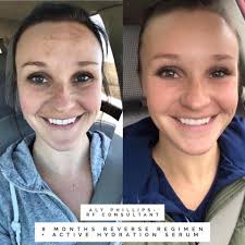 Rodan and Fields by Gretchen