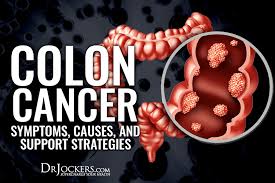 Some polyps have a stalk and others do not. Colon Cancer Symptoms Causes And Support Strategies
