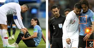 Uruguay is heading into their first matchup in the knockout phase riding on a wave of confidence, thanks to their defense not having not given up a single goal during their perfect run at the cup thus far. Cavani Number Printed Upside Down In Uruguay Vs Portugal 2018 World Cup Clash Footy Headlines