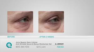 Been using it for 4 year straight. Juice Beauty Stem Cellular Serum Reviews Online Discount Shop For Electronics Apparel Toys Books Games Computers Shoes Jewelry Watches Baby Products Sports Outdoors Office Products Bed Bath Furniture Tools