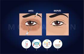 Circulos Oscuros De Los Ojos