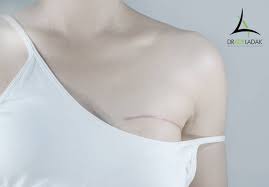 Gallery - Plastic Surgery In Edmonton