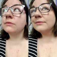 Some before and after pictures 🤷🏻‍♂️