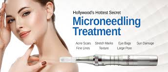 Maybe you would like to learn more about one of these? Acne Microneedling And Prp Platelet Rich Plasma Treatment Skin Solutions New York