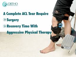 A Complete Acl Tear Require Surgery Recovery Time With Aggressive Physical Therapy Acl Tear Surgery Therapy In 2020 Surgery Recovery Orthopedics Acl Tear