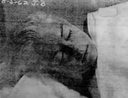 The Marilyn Monroe Autopsy Photo