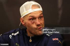 26,142 Post Fight Stock Photos, High-Res Pictures, and Images