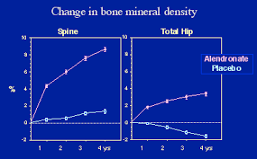 Image result for Bisphosphonates