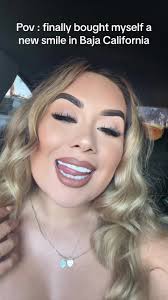 ME era ✨🤍 #fyp #veneers #mexico