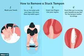 Once you feel the tampon is comfortably positioned, hold the grip and push the tampon inside your body using the inner tube of the applicator. How To Remove A Stuck Tampon