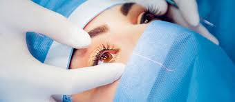 Femtolasik Bicaksiz Lasik Nedir