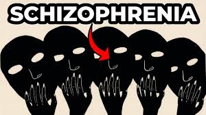 This test takes account of both positive and negative symptoms of. Do You Suffer From Schizophrenia Test Youtube