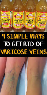 Pin On Remedies That Work