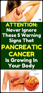 Typical warning signs of pancreatic cancer include: Pin On Health