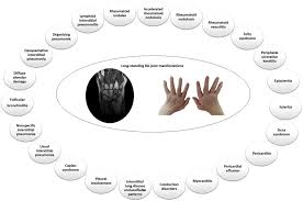 Get access to exclusive content and experiences on the world's largest membership platform for artists and creators. Beyond The Joints The Extra Articular Manifestations In Rheumatoid Arthritis Sciencedirect