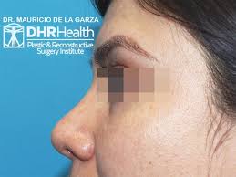 DHR Health Plastic & Reconstructive Surgery Institute (@dhrhealthplastics)  • Instagram photos and videos