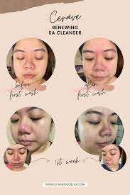 Cerave sa smoothing cleanser for the face and body. Best Cerave Cleanser For Acne Prone And Sensitive Skin Wild And Sassy