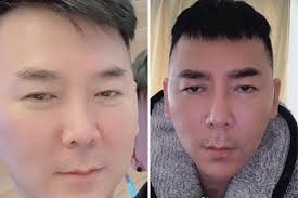 Bought casting creme gloss in shade chocolate to use straight after the colour b4 process but again, won't be doing this for at least a month or so. Celebrity Hairstylist Addy Lee S Plastic Surgeries Go Wrong Wants To Sue Entertainment News Asiaone