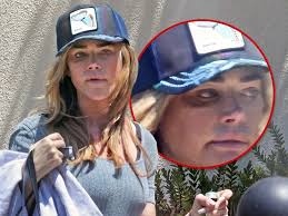 Denise Richards Sports Apparent Black Eye Days After Showing Up at  Estranged Husband's House
