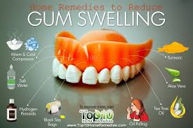 Home Remedies To Reduce Gum Swelling Top 10 Home Remedies Gum Disease Remedies Swollen Gum Swollen Gums Remedy