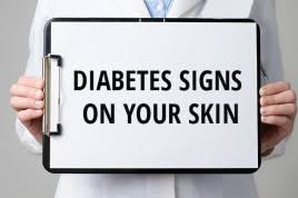 We did not find results for: Diabetes 12 Warning Signs That Appear On Your Skin