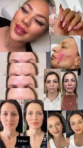 Beauty and esthetic services in Alanya