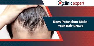 Hair growth rate varies widely among people. Does Potassium Make Your Hair Grow Clinicexpert International Hair Transplant Plastic Surgery