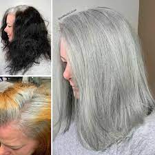 Hair loss on legs is common with age in men and women. Lef Grey Hair