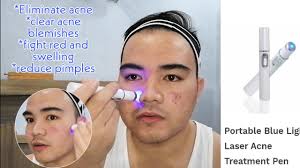 Day1 Kd 7910 Blue Light Acne Lacer Treatment Review Youtube