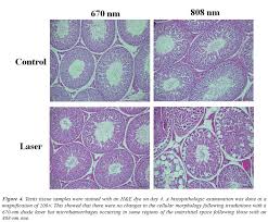 The Effects Of Low Level Laser Therapy Lllt On The Testis In Elevating Serum Testosterone Level In Rats