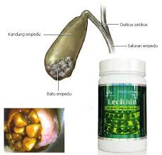 Obat Penghancur Batu Empedu Di Apotik Herbal Botol Batu