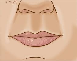 Image result for Lip Cancer