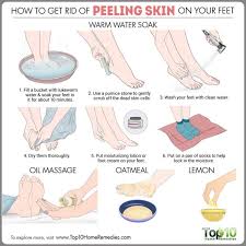 How To Get Rid Of Peeling Skin On Your Feet Top 10 Home Remedies Peeling Skin Skin Care Steps Oily Skin Care