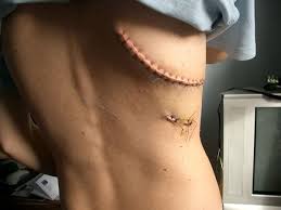 Pin On Blood