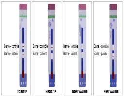 Possible Results Of The Test By Alere Determine Hiv 1 2 Download Scientific Diagram