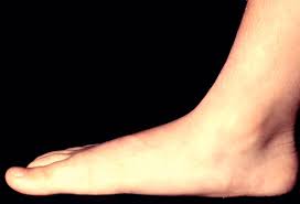 By joining our free global community of podiatrists and other interested foot health care professionals you will have access to post podiatry topics (answer and ask questions). Pictures Of Common Foot Problems