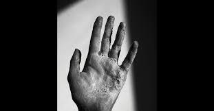 You Re Showering Too Much In 2020 Demodex Microbiome Clean Skin