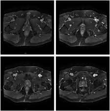 Cjk unified ideographs extension b. Mri V E Maps For A Real Case Of Prostate Image With 256 A 256 A 56 Download Scientific Diagram