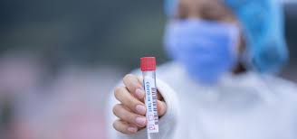 Us oferim l'última hora dels nous casos de coronavirus arreu dels països catalans. Espana Registra 149 Nuevos Casos De Covid 19 En 24 Horas