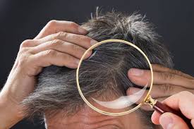 حل مشكلة الشعر الجاف للرجال بـ 7 طرق سهلة - شَعَر.كوم