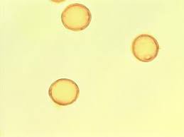 Image result for Maclura africana