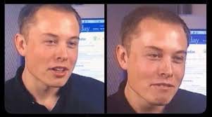 Origin of darkalopecia term