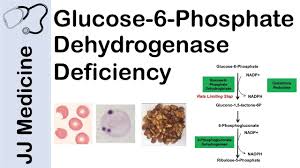 List of food stuff to be avoided by g6pd patients. Glucose 6 Phosphate Dehydrogenase Deficiency Symptoms Pathophysiology Diagnosis And Treatment Youtube