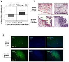 Currency calculator to convert money from euro (eur) to romanian new leu (ron) using up to date exchange rates. Ijms Free Full Text Lysophosphatidic Acid Upregulates Recepteur D Origine Nantais Expression And Cell Invasion Via Egr 1 Ap 1 And Nf Kb Signaling In Bladder Carcinoma Cells Html