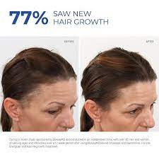 This formula is optimized for women as they can also experience hair loss problems. Bosley Women S Hair Regrowth Treatment With Minoxidil Ulta Beauty