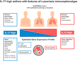Learn vocabulary, terms and more with flashcards, games and other study tools. Il 17 High Asthma With Features Of A Psoriasis Immunophenotype Journal Of Allergy And Clinical Immunology